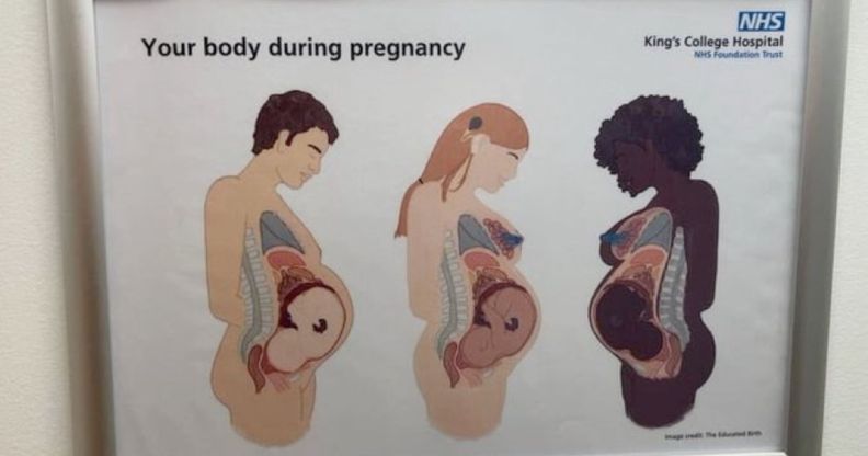 A fake NHS diagram on a wall showcasing three pregnant people