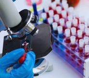 A person looking at a blood sample under a microscope.