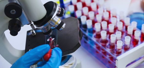 A person looking at a blood sample under a microscope.