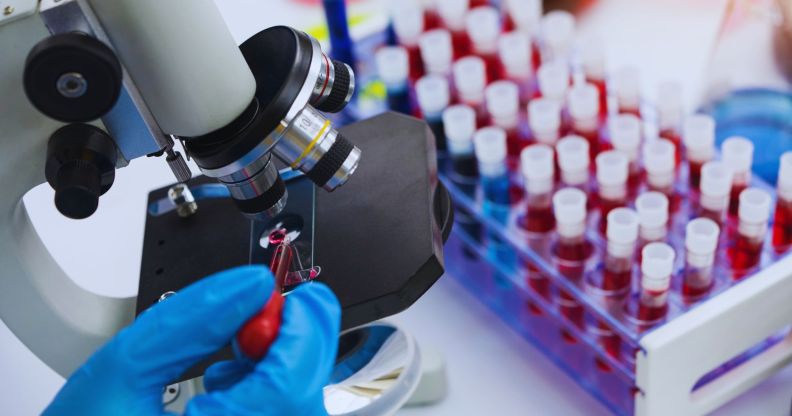 A person looking at a blood sample under a microscope.