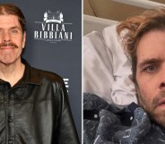 Perez Hilton ended up in hospital with sepsis