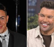 Bobby Norris has had a facelift