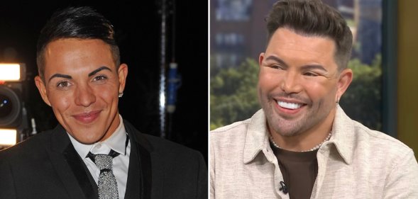 Bobby Norris has had a facelift