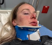 Celia Haueter suffered severe head injuries in the attack. (GoFundMe)