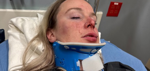 Celia Haueter suffered severe head injuries in the attack. (GoFundMe)