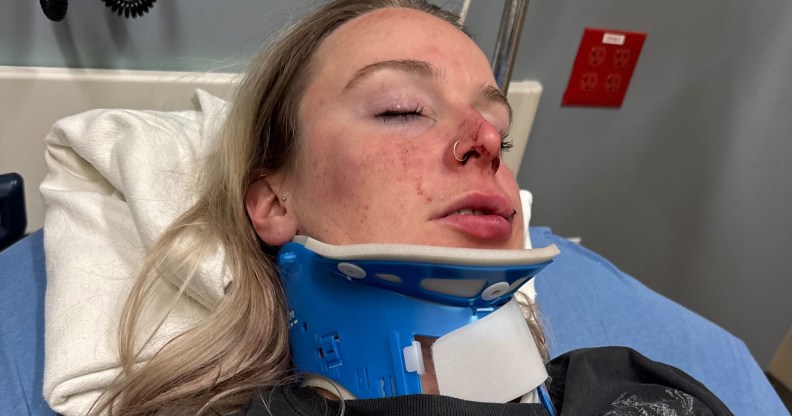Celia Haueter suffered severe head injuries in the attack. (GoFundMe)