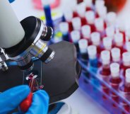 A person looking at a blood sample under a microscope.