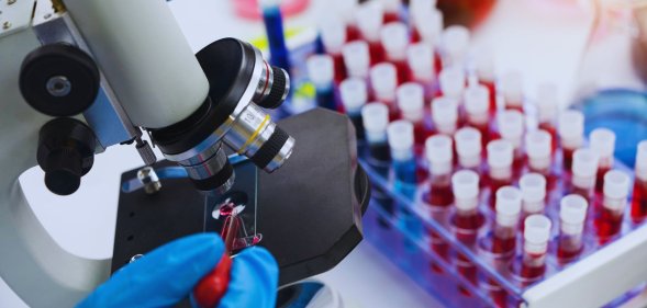 A person looking at a blood sample under a microscope.