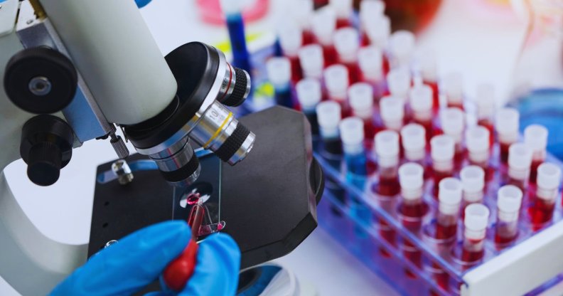 A person looking at a blood sample under a microscope.